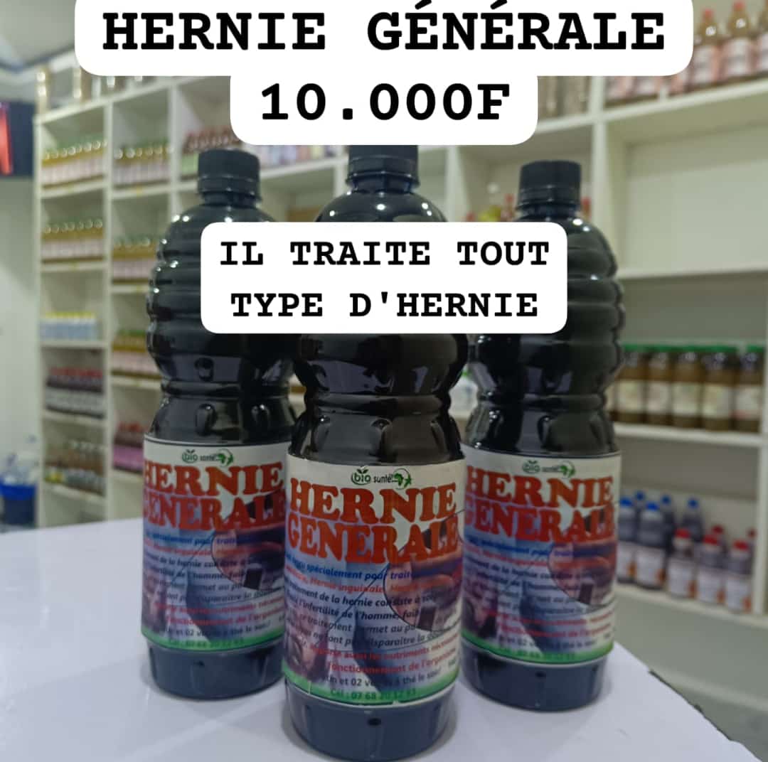 Hernie générale: hernie inguinale, hernie ombilicale, hernie hiatale, hernie crurale..
