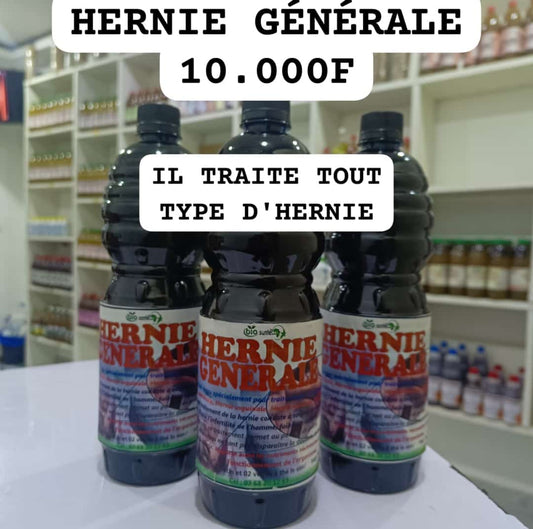 Hernie générale: hernie inguinale, hernie ombilicale, hernie hiatale, hernie crurale..